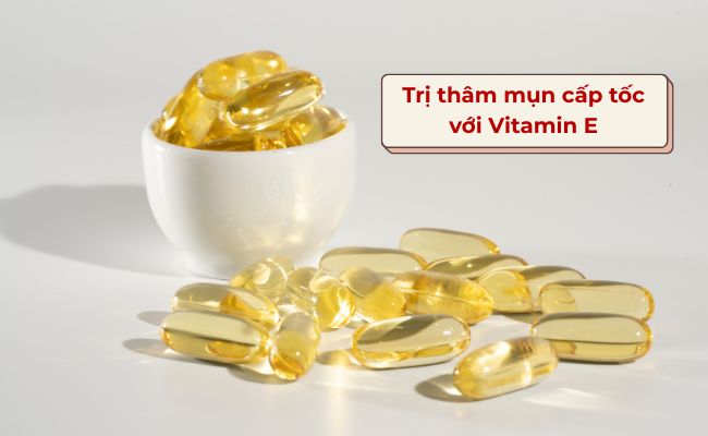 Phương pháp trị thâm mụn cấp tốc với Vitamin E