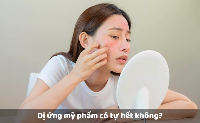 Dị ứng mỹ phẩm có tự hết không?