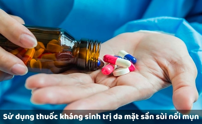Sử dụng thuốc kháng sinh
