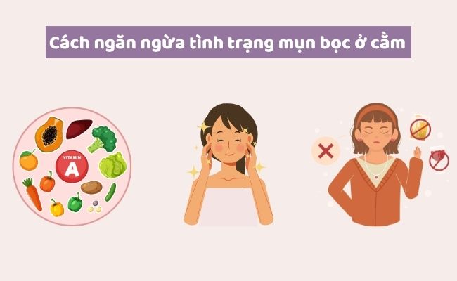 Cách ngăn ngừa tình trạng mụn bọc ở cằm