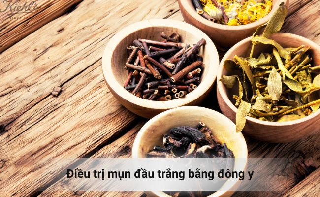 Điều trị mụn bằng đông y