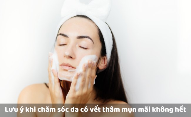 Lưu ý khi chăm sóc da có những vết thâm mụn mãi không hết