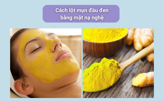 Cách lột mụn đầu đen tại nhà đơn giản, hiệu quả