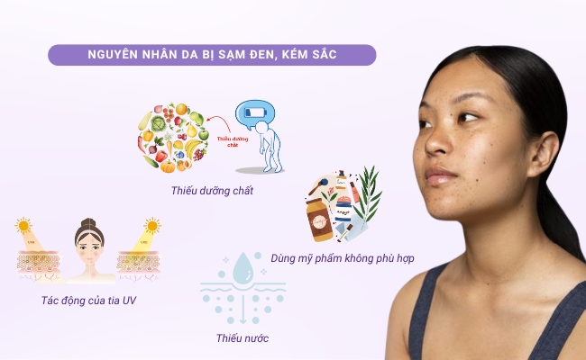 Da sạm đen, kém sắc do đâu?