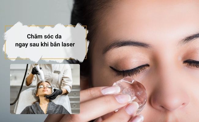 Ngay sau khi bắn laser, bạn nên chườm lạnh để giảm sưng đỏ và nóng rát