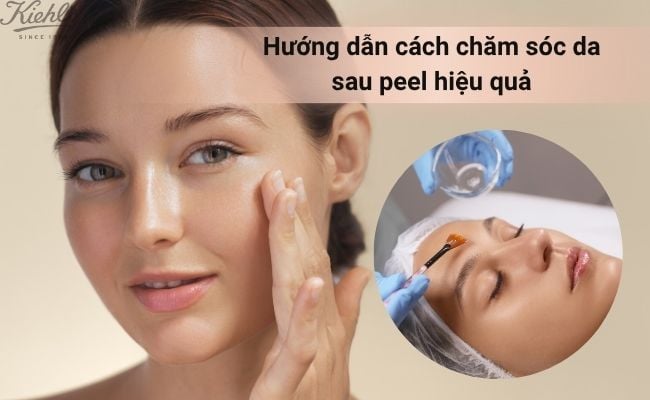 Hướng dẫn cách chăm sóc da sau peel hiệu quả