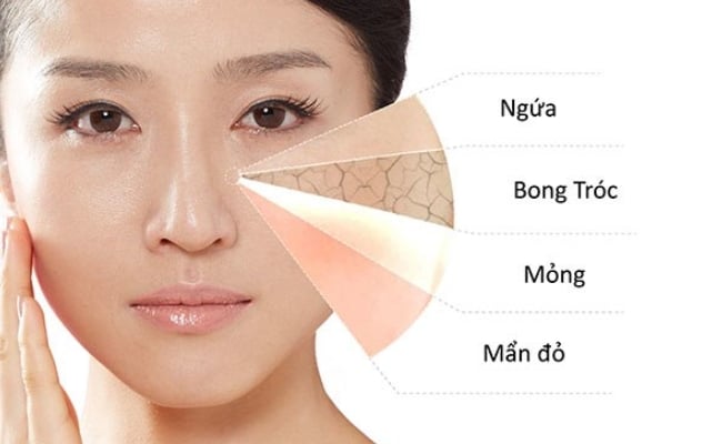 Cách Làm Mặt Nạ Dưỡng Ẩm Cho Da Khô