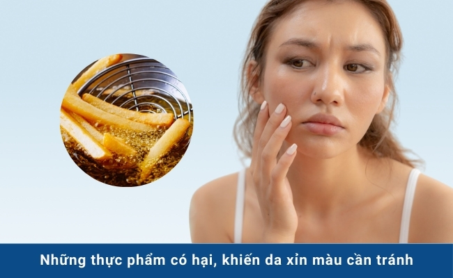 Thức ăn chứa nhiều dầu mỡ làm tăng nguy cơ da xỉn màu