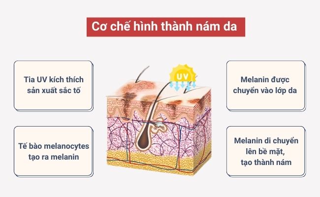 Cơ chế hình thành nám da