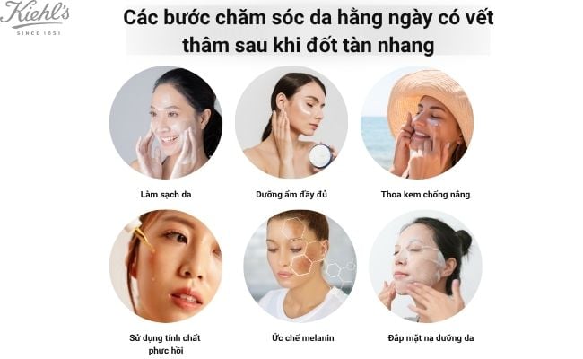Các bước chăm sóc da hằng ngày có vết thâm sau khi đốt tàn nhang