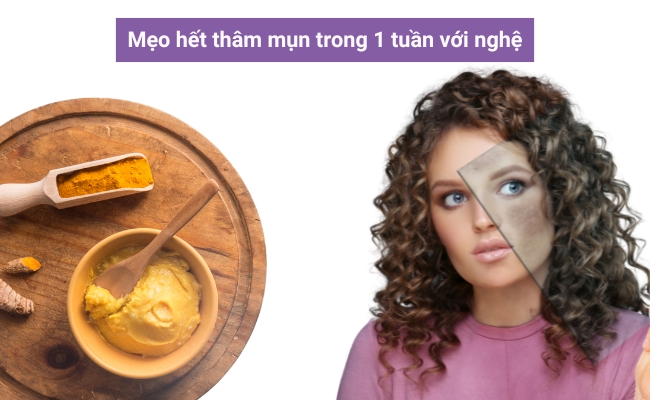 Mẹo trị hết thâm thâm mụn trong 1 tuần với nghệ giúp cho làn da sáng mịn