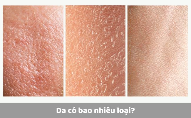 Da có bao nhiêu loại?
