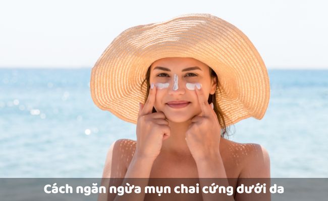 Cách ngăn ngừa mụn chai cứng dưới da