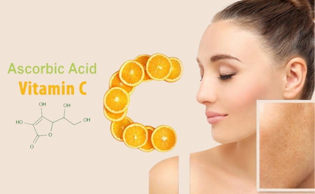 Sử dụng vitamin c để cải thiện tình trạng tăng sắc tố