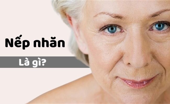 Nếp nhăn là gì?