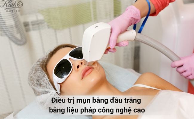 Sử dụng các loại thuốc uống, thuốc bôi trị mụn đầu trắng kê đơn