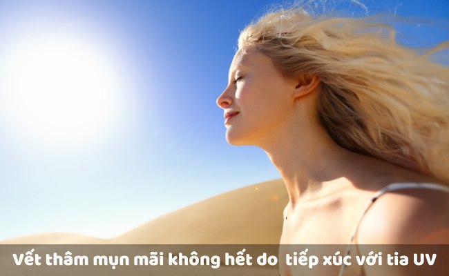 Tại sao vết thâm mụn mãi không hết?
