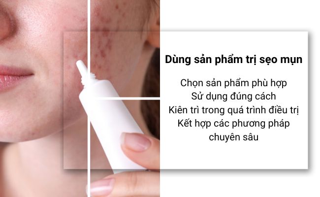 20+ cách trị sẹo mụn 1