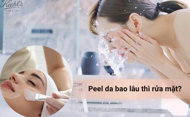 Peel da bao lâu thì rửa mặt