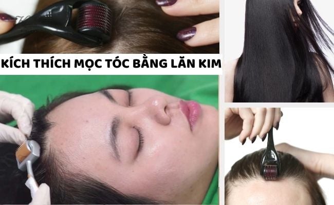 15 Cách mọc tóc nhanh tại nhà trong 1 tuần