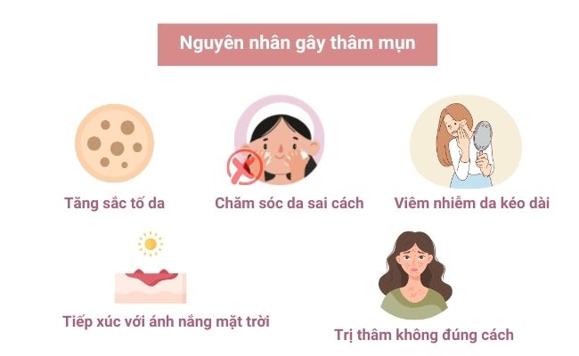 Nguyên nhân gây thâm mụn
