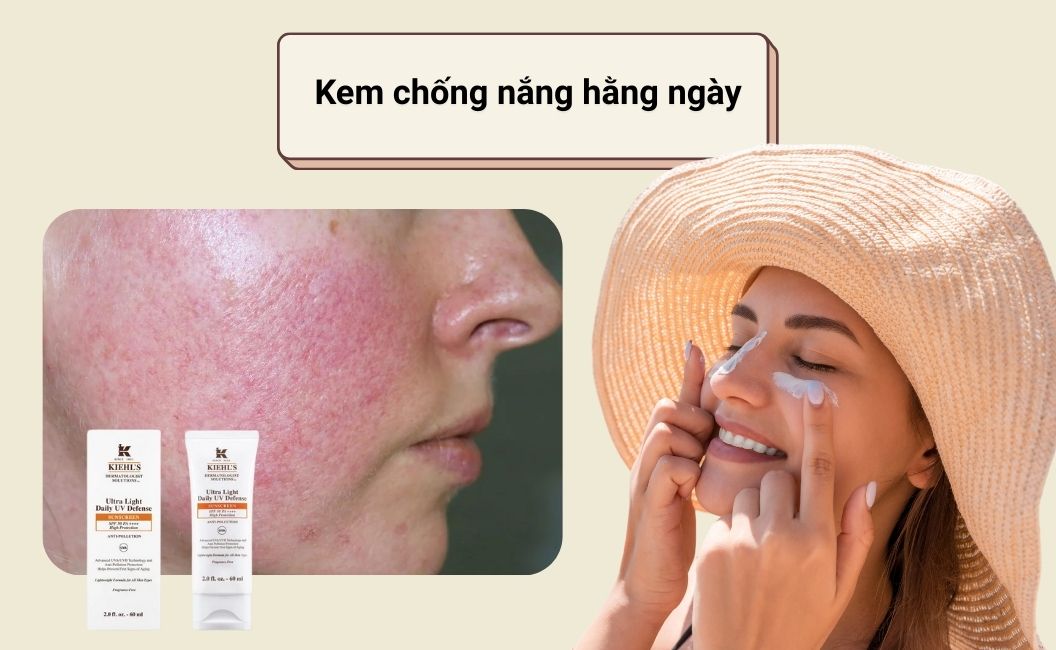 kem chống nắng hằng ngày