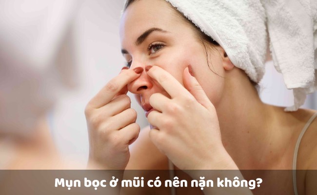 Mụn bọc ở mũi có nên nặn không?