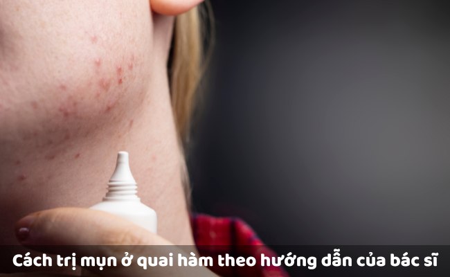 Cách điều trị mụn ở quai hàm an toàn, hiệu quả nhất


