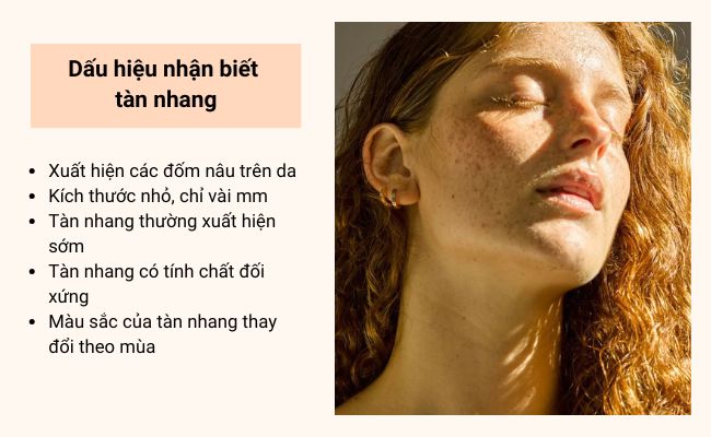 Dấu hiệu nhận biết của tàn nhang