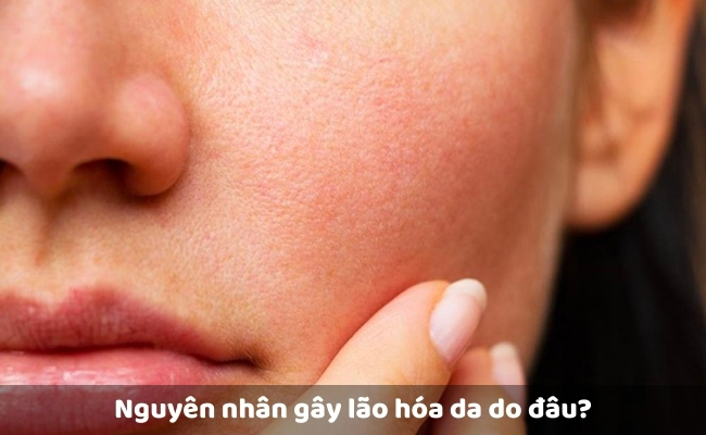 Nguyên nhân gây lão hóa da