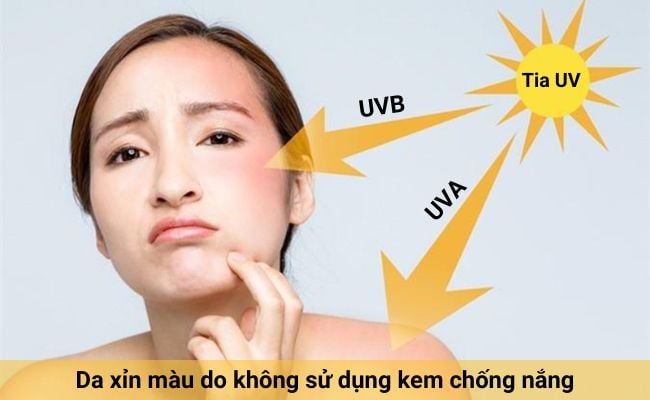 Nguyên nhân gây ra da bị xỉn màu