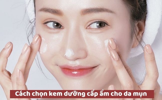 Cách chọn kem dưỡng cấp ẩm cho da mụn