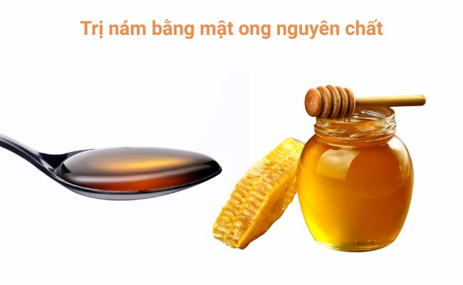 Trị nám bằng mật ong nguyên chất