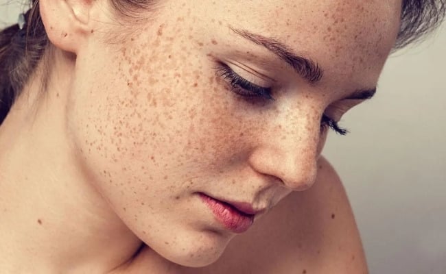 ”Retinol