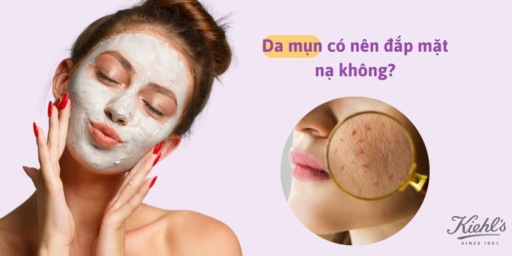 Da mụn có nên đắp mặt nạ không?