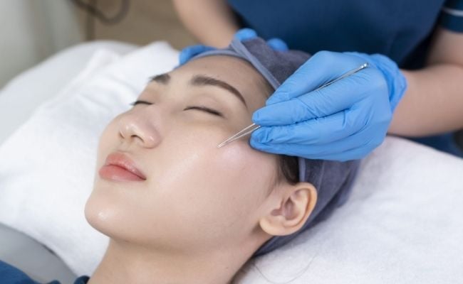 Lấy nhân mụn chuẩn y khoa