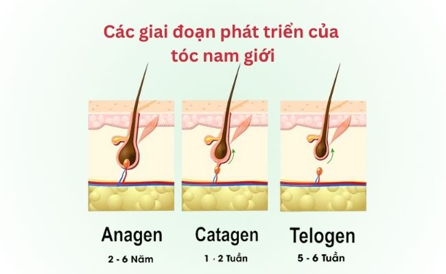 Các giai đoạn phát triển của tóc nam giới