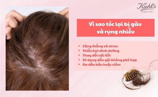 Vì sao tóc lại bị gàu và rụng nhiều