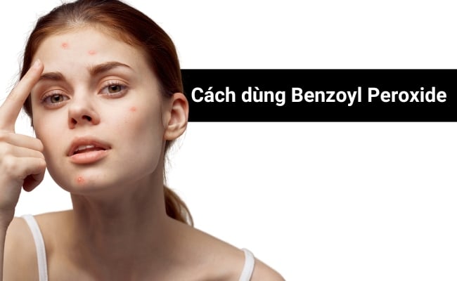 cách sử dụng Benzoyl Peroxide