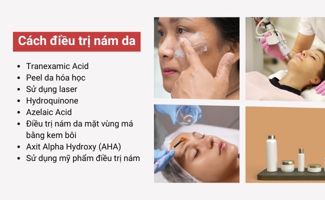 Cách điều trị nám da hiệu quả, an toàn