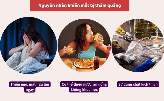 Nguyên nhân khiến mắt bị thâm quầng

