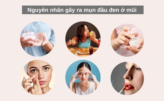 Nguyên nhân gây ra mụn đầu đen ở mũi
