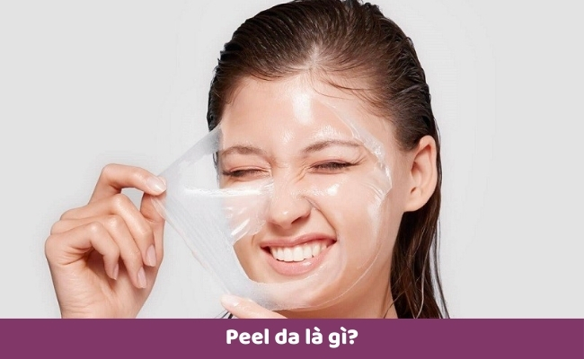 Peel da là gì?