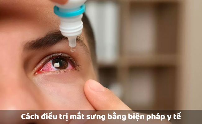 Cách khắc phục và điều trị mắt sưng bằng biện pháp y tế