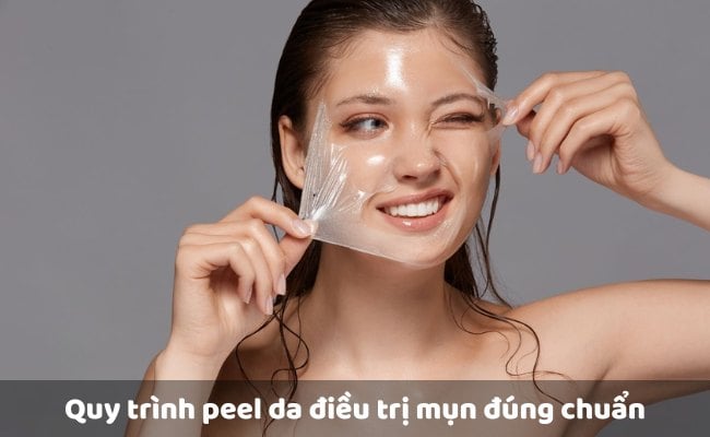 Quy trình peel da điều trị mụn đúng chuẩn