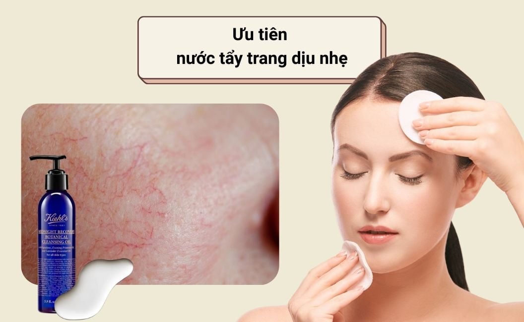 Ưu tiên nước tẩy trang dịu nhẹ cho da nhạy cảm