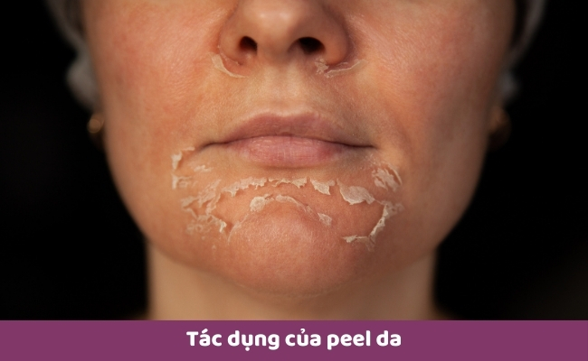 Tác dụng của peel da 