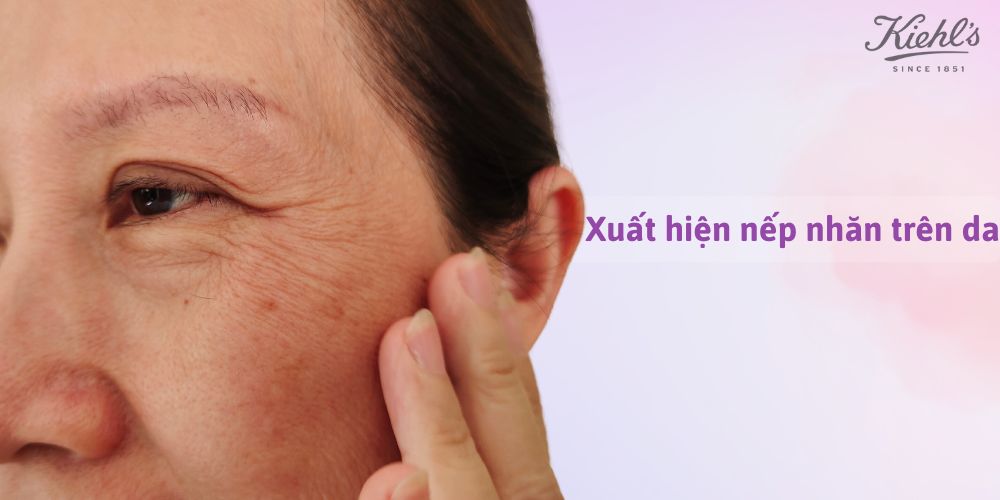 14 dấu hiệu lão hóa da thường gặp