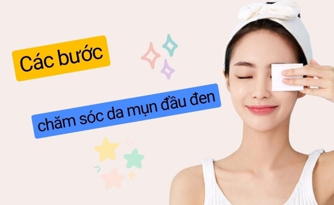 Cách chăm sóc da bị mụn đầu đen