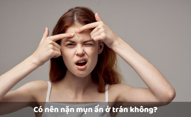 Có nên nặn mụn ẩn ở trán không?